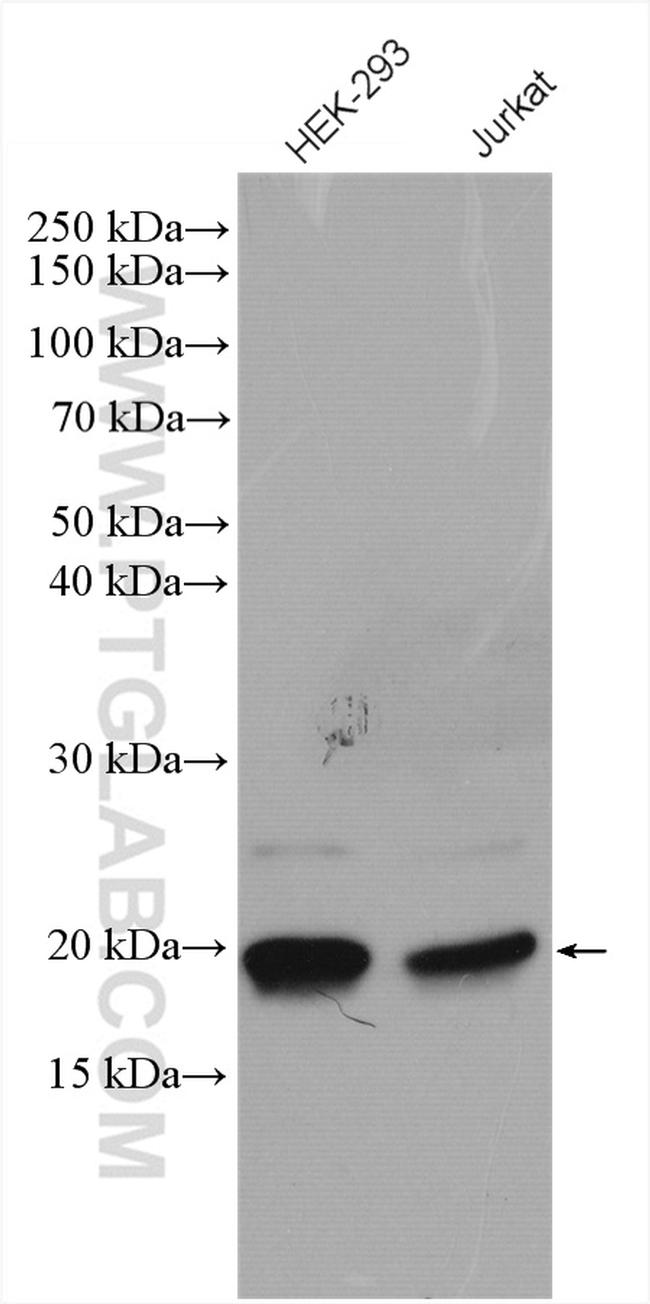 BTF3L4 Antibody in Western Blot (WB)