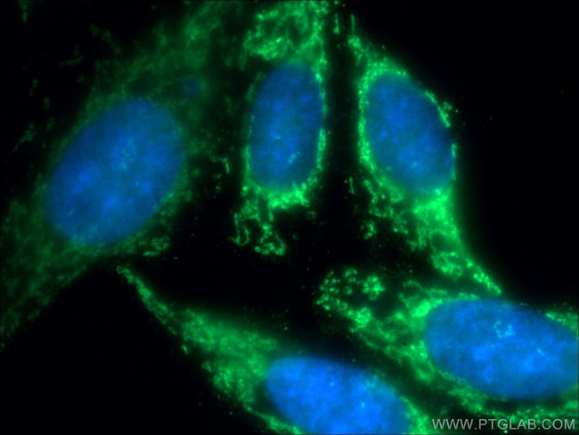CXXC5 Antibody in Immunocytochemistry (ICC/IF)