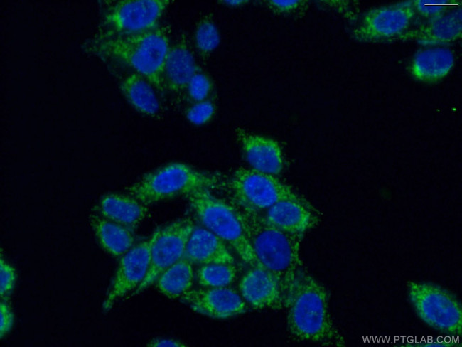 MRPL19 Antibody in Immunocytochemistry (ICC/IF)