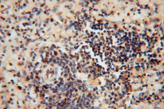 RNASEH2C Antibody in Immunohistochemistry (Paraffin) (IHC (P))