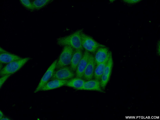 ARFGAP2 Antibody in Immunocytochemistry (ICC/IF)