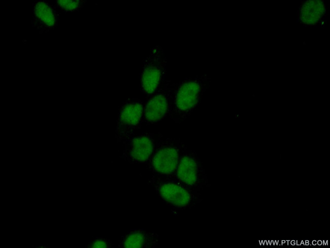SURF2 Antibody in Immunocytochemistry (ICC/IF)