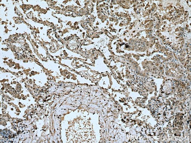 METTL6 Antibody in Immunohistochemistry (Paraffin) (IHC (P))