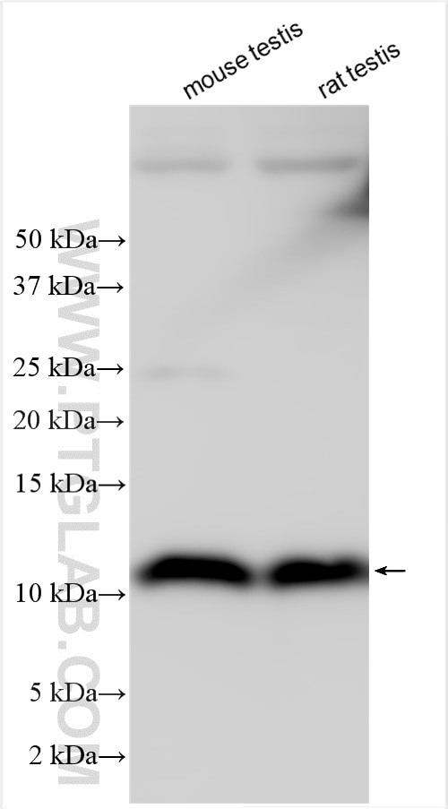 DYNLRB2 Antibody in Western Blot (WB)
