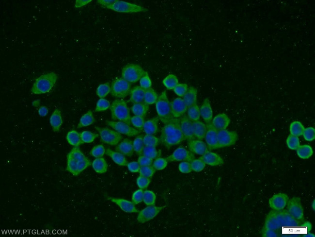 CCKBR Antibody in Immunocytochemistry (ICC/IF)