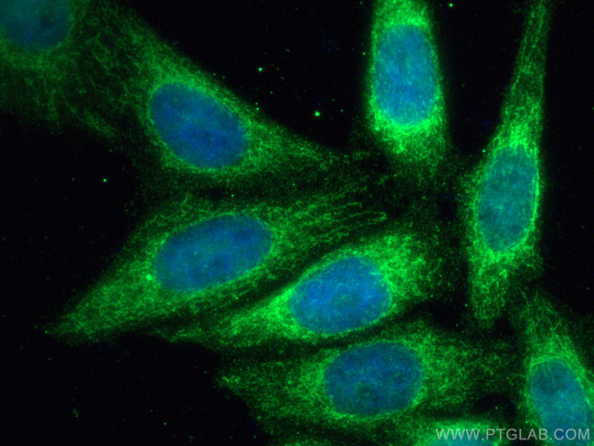 CYP19A1 Antibody in Immunocytochemistry (ICC/IF)