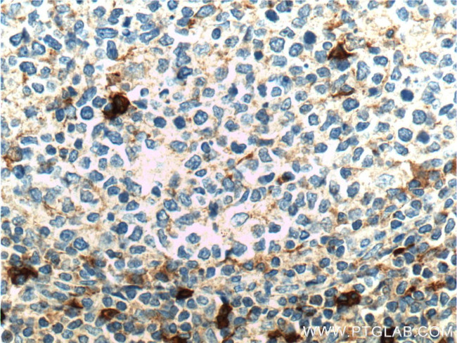 CD16 Antibody in Immunohistochemistry (Paraffin) (IHC (P))