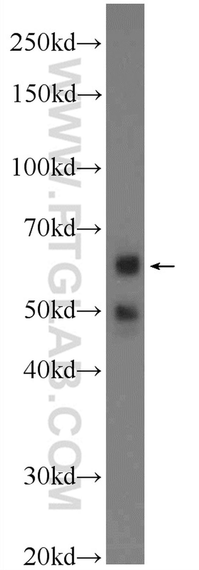 PPP2R2A Antibody in Western Blot (WB)