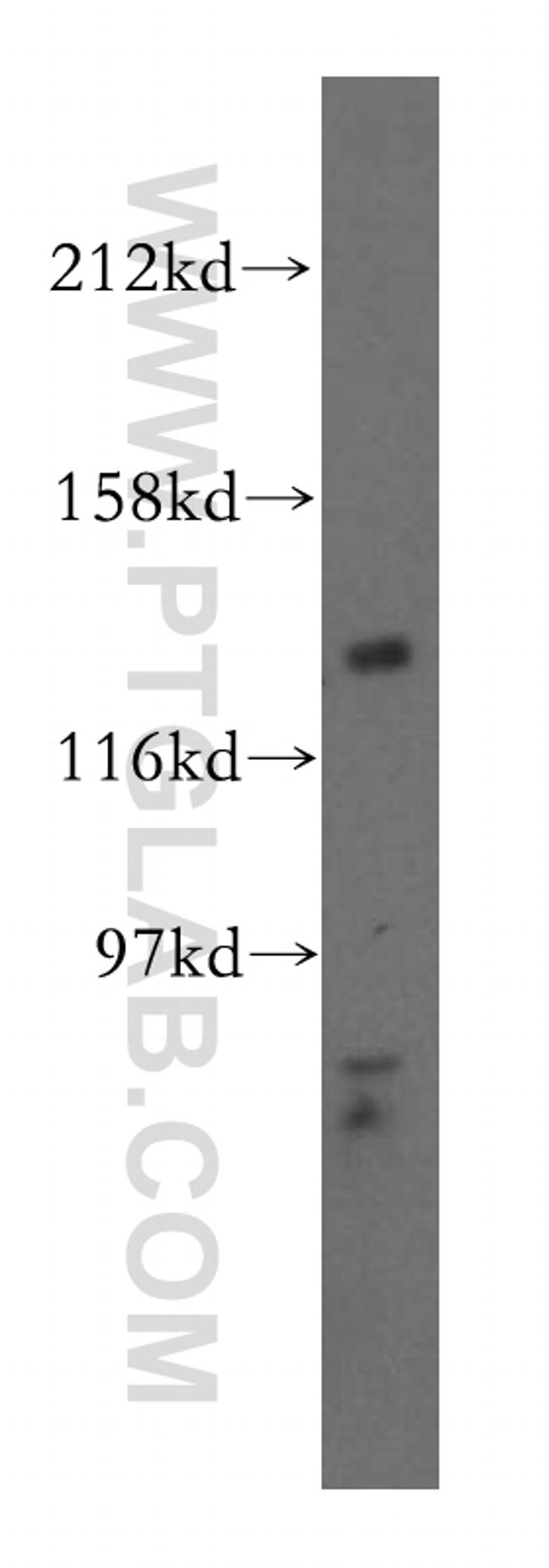 POLR3B Antibody in Western Blot (WB)