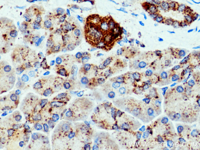 CTSZ Antibody in Immunohistochemistry (Paraffin) (IHC (P))