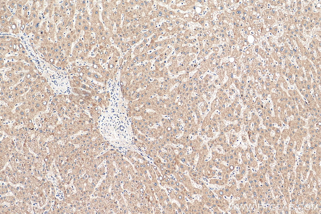 CFHR3 Antibody in Immunohistochemistry (Paraffin) (IHC (P))