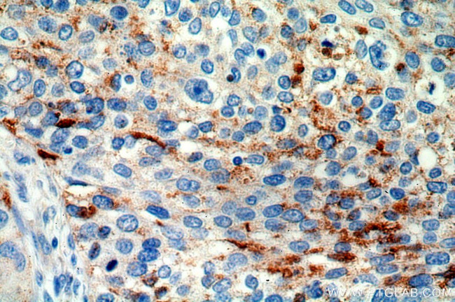 MRPL3 Antibody in Immunohistochemistry (Paraffin) (IHC (P))