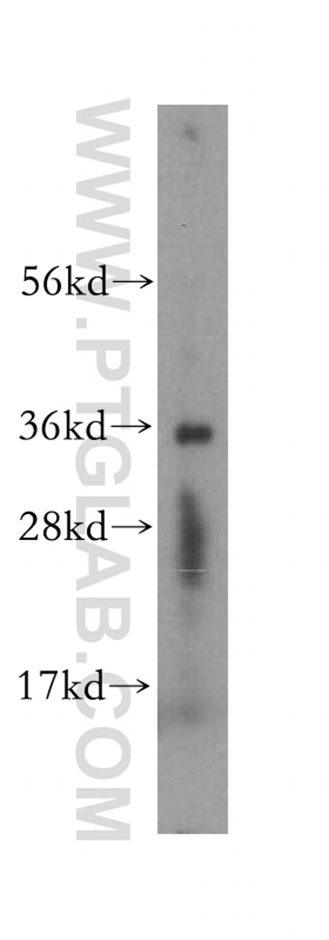 SDR39U1 Antibody in Western Blot (WB)