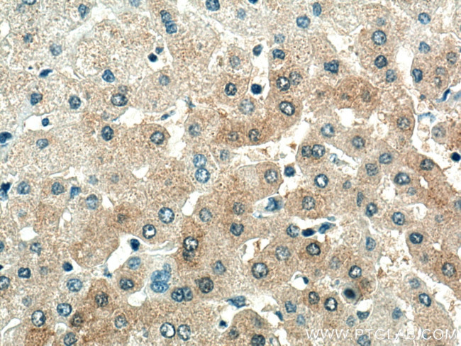 SDS Antibody in Immunohistochemistry (Paraffin) (IHC (P))