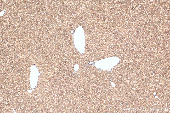 ZNHIT1 Antibody in Immunohistochemistry (Paraffin) (IHC (P))