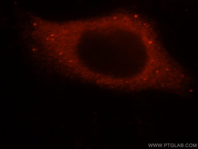 SMAP2 Antibody in Immunocytochemistry (ICC/IF)