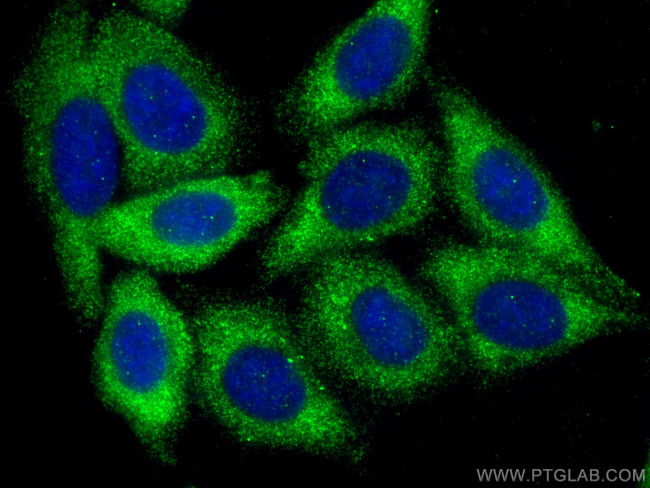 SPTLC3 Antibody in Immunocytochemistry (ICC/IF)