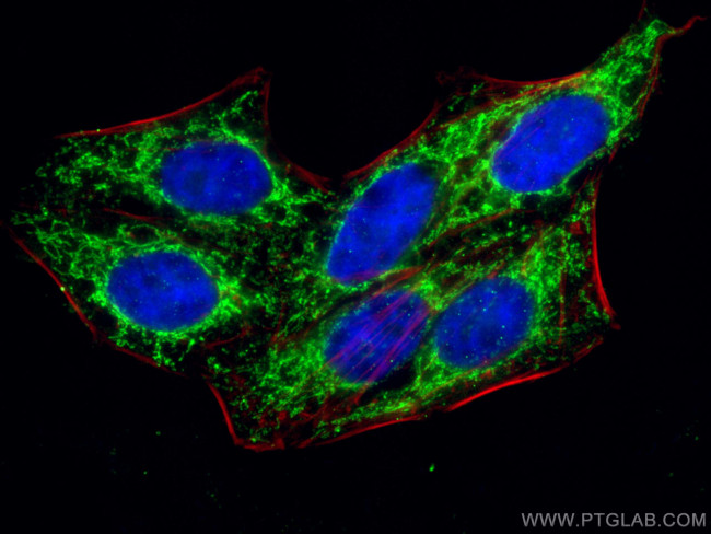TFB1M Antibody in Immunocytochemistry (ICC/IF)