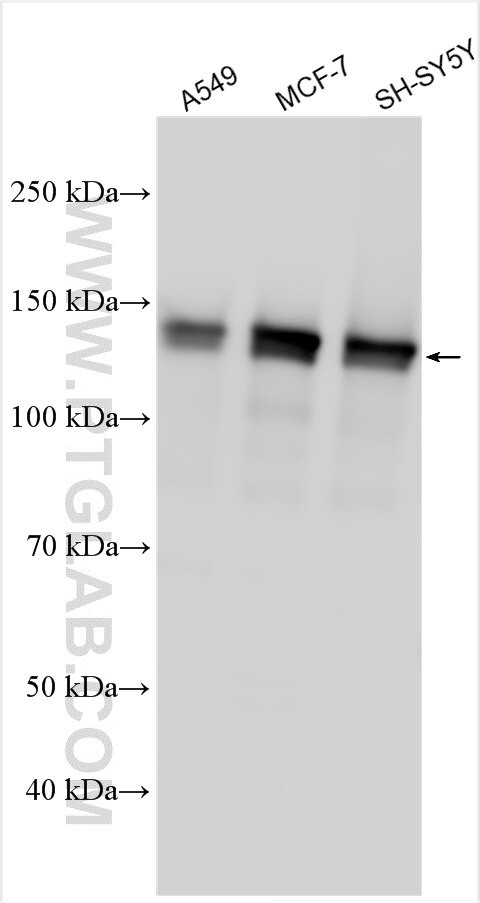 FTSJ3 Antibody in Western Blot (WB)