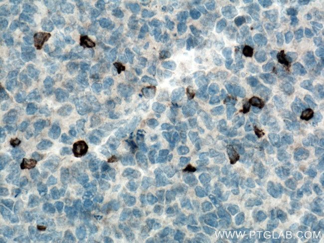 LAG-3 Antibody in Immunohistochemistry (Paraffin) (IHC (P))