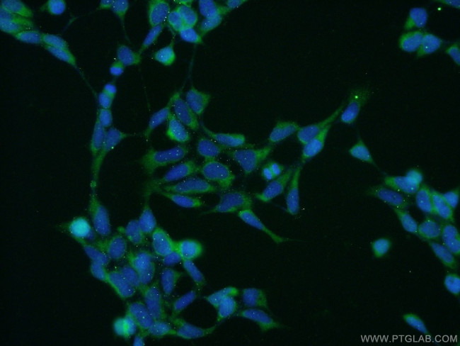 CAD Antibody in Immunocytochemistry (ICC/IF)