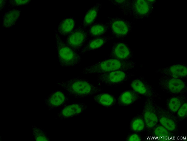 INTS3 Antibody in Immunocytochemistry (ICC/IF)