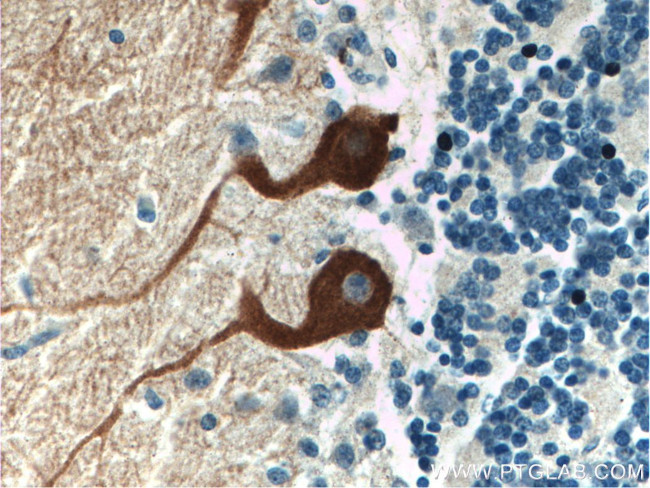 HOMER3 Antibody in Immunohistochemistry (Paraffin) (IHC (P))