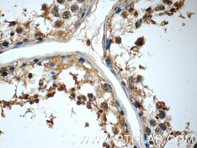 MRPL36 Antibody in Immunohistochemistry (Paraffin) (IHC (P))