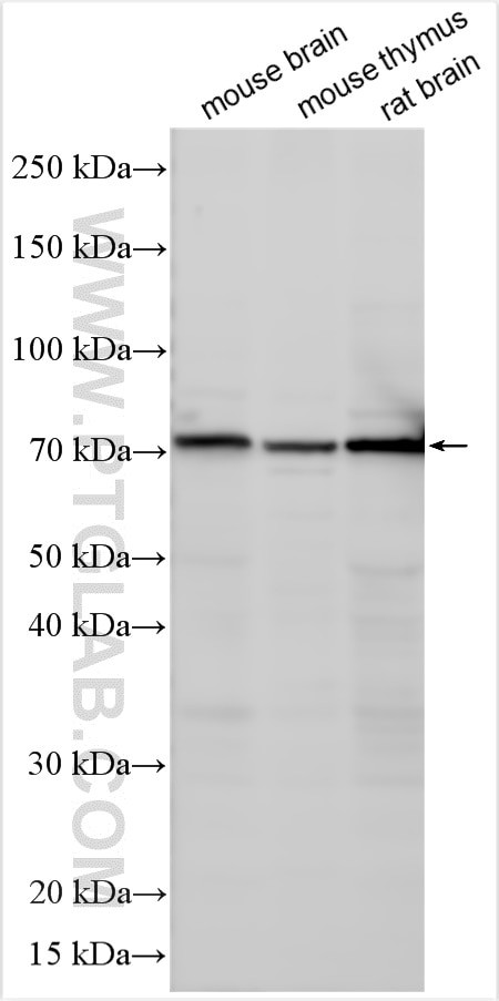 CRTAM Antibody in Western Blot (WB)