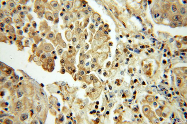 SEPHS1 Antibody in Immunohistochemistry (Paraffin) (IHC (P))