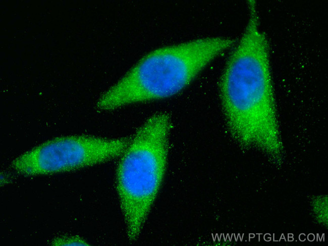 TMUB1 Antibody in Immunocytochemistry (ICC/IF)