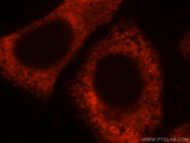 RPL28 Antibody in Immunocytochemistry (ICC/IF)