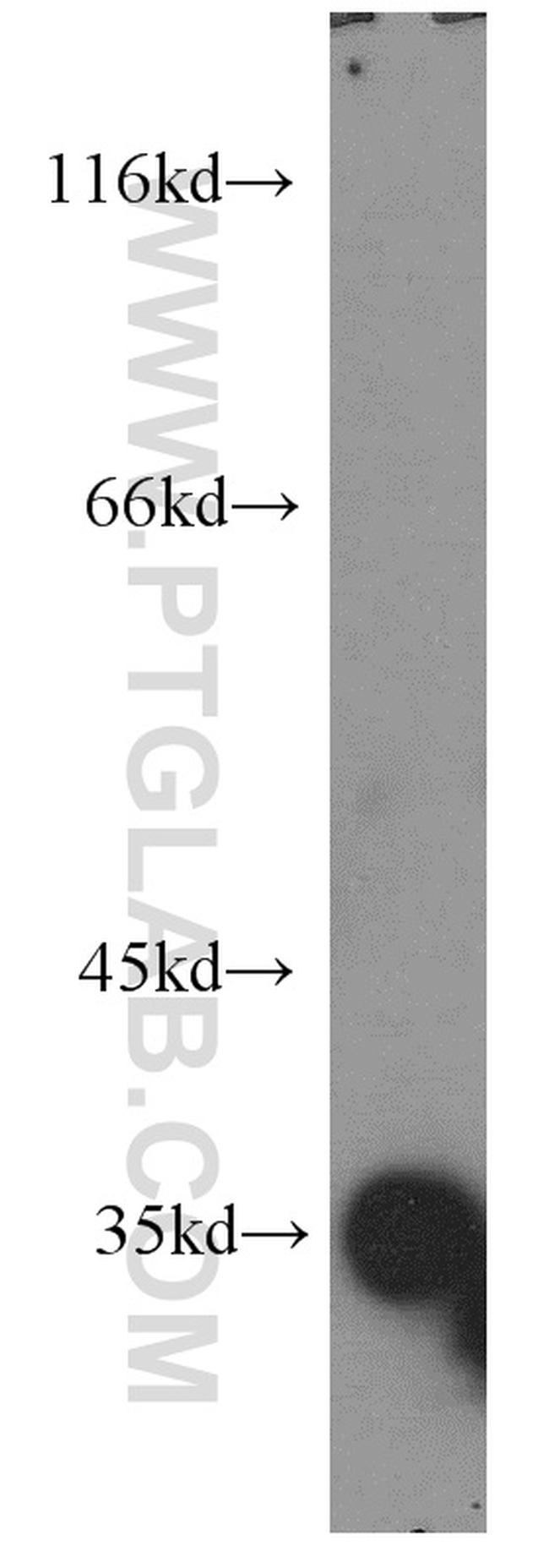PRPS1L1 Antibody in Western Blot (WB)
