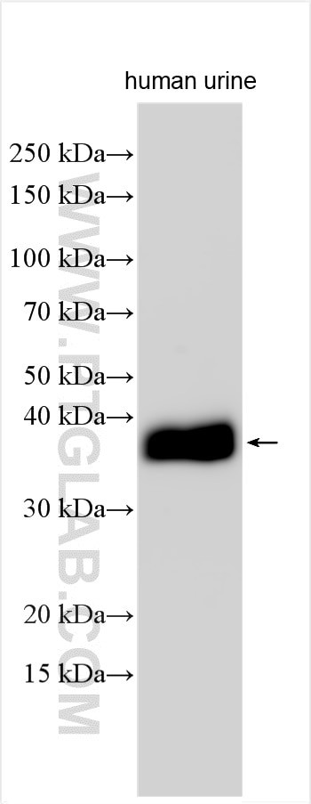 DNase I Antibody in Western Blot (WB)