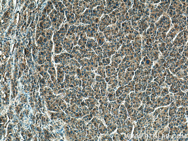 Haptoglobin Antibody in Immunohistochemistry (Paraffin) (IHC (P))