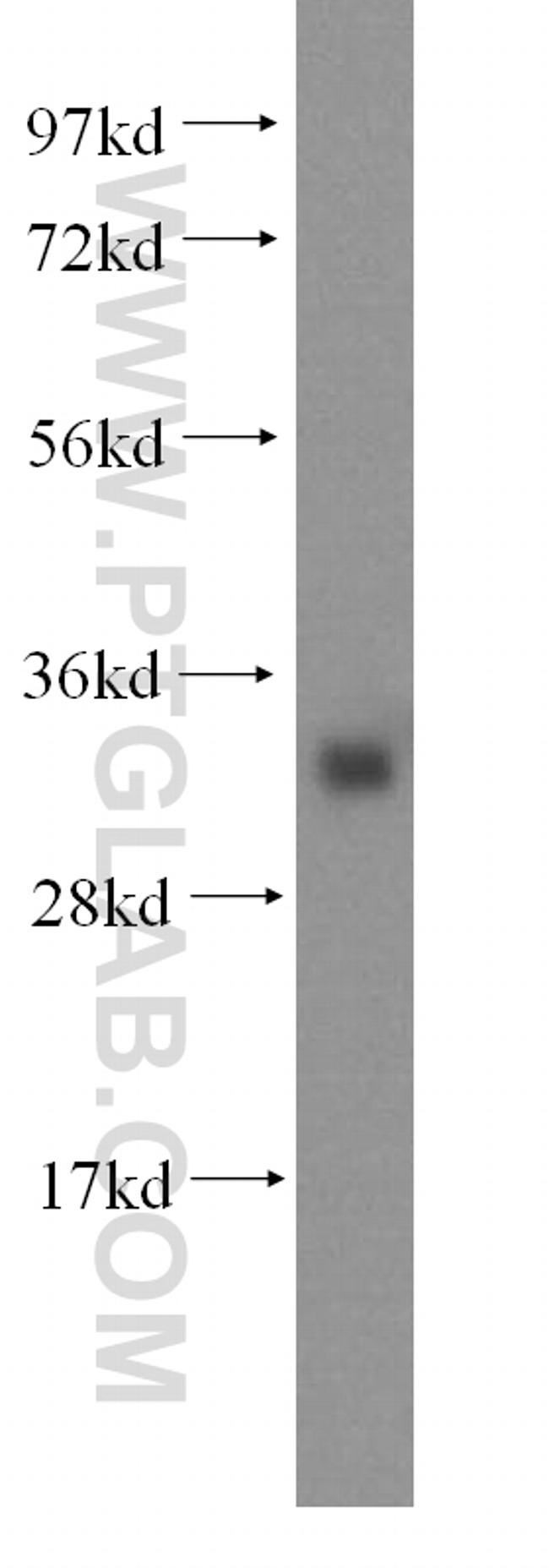IYD Antibody in Western Blot (WB)