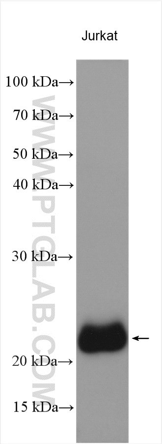 CD3 delta Antibody in Western Blot (WB)