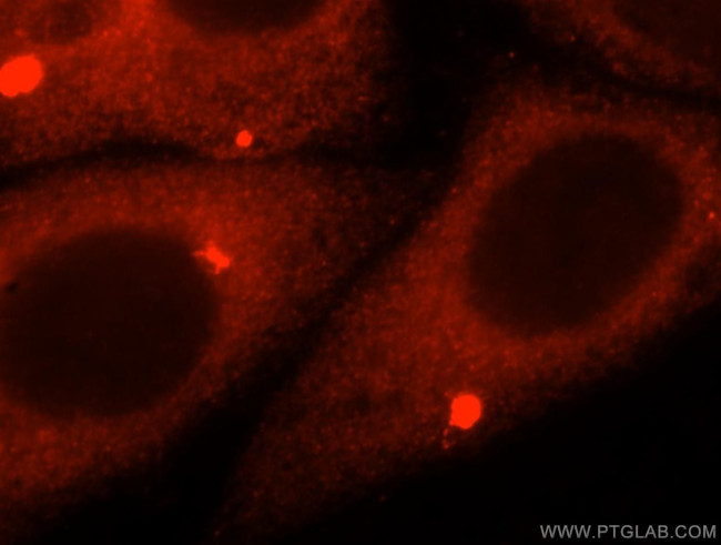 AMFR Antibody in Immunocytochemistry (ICC/IF)
