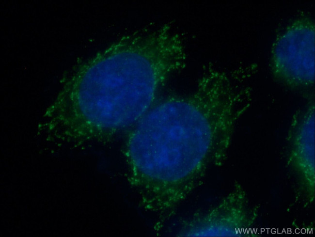 RPS13 Antibody in Immunocytochemistry (ICC/IF)