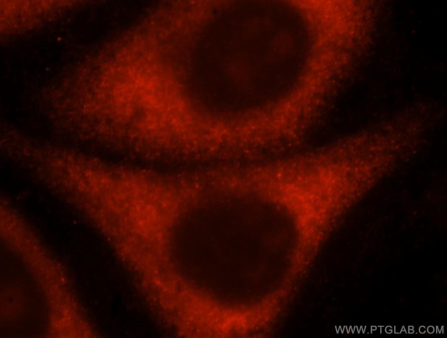 RPL10A Antibody in Immunocytochemistry (ICC/IF)
