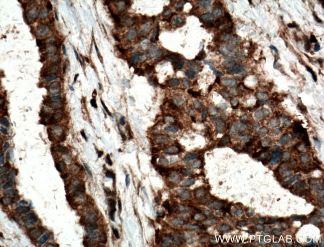 TOMM6 Antibody in Immunohistochemistry (Paraffin) (IHC (P))