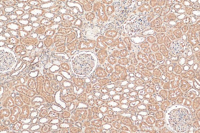 PARP11 Antibody in Immunohistochemistry (Paraffin) (IHC (P))