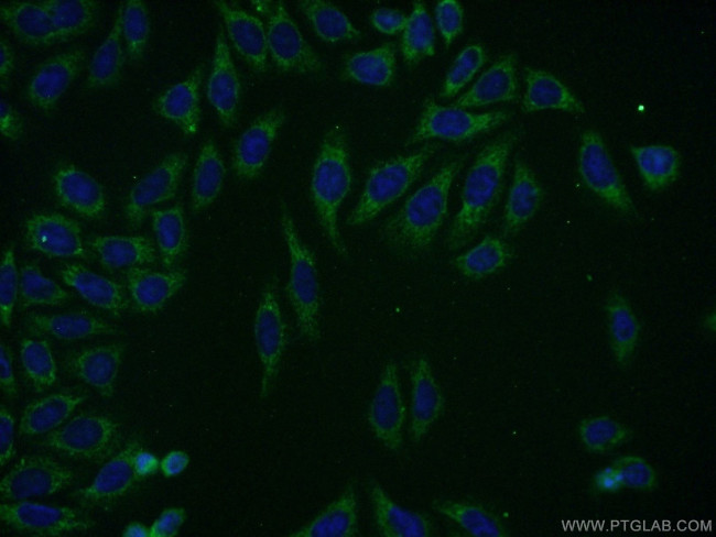 KLHL14 Antibody in Immunocytochemistry (ICC/IF)