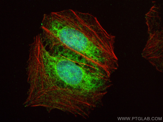 NAA40 Antibody in Immunocytochemistry (ICC/IF)