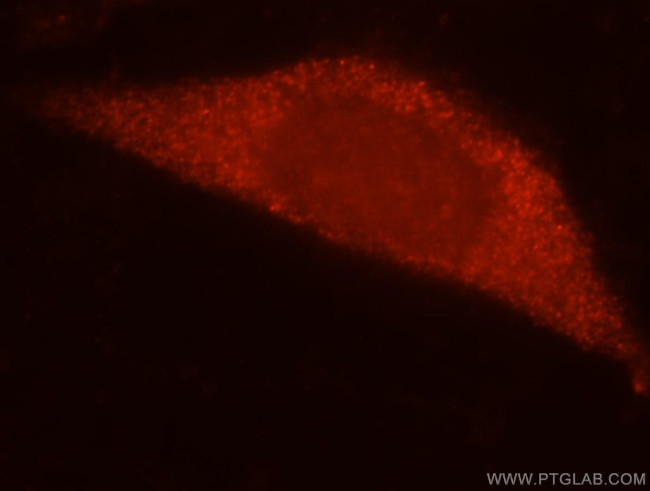 RPL7L1 Antibody in Immunocytochemistry (ICC/IF)