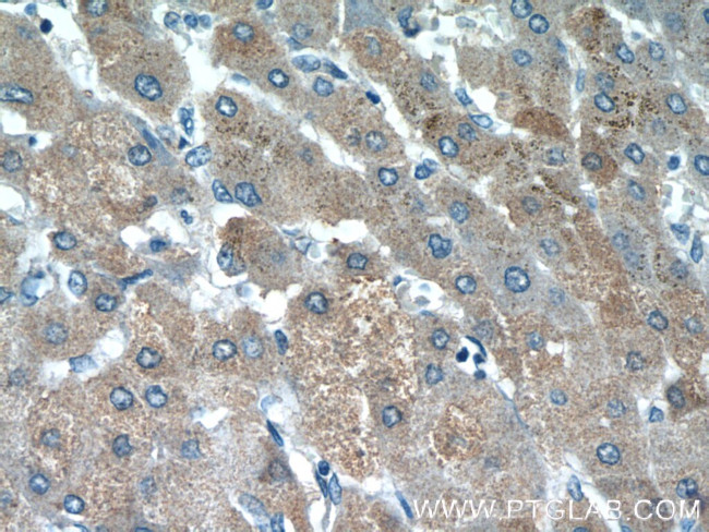 HSPC159 Antibody in Immunohistochemistry (Paraffin) (IHC (P))