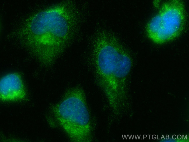 DMPK Antibody in Immunocytochemistry (ICC/IF)