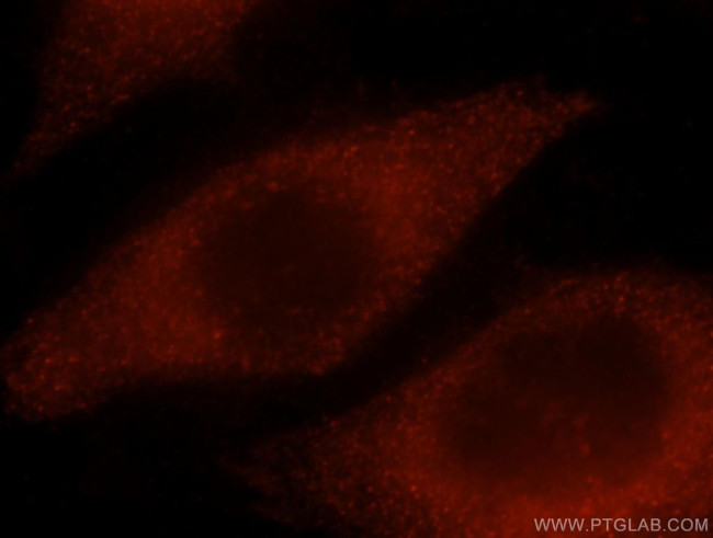 NPL Antibody in Immunocytochemistry (ICC/IF)