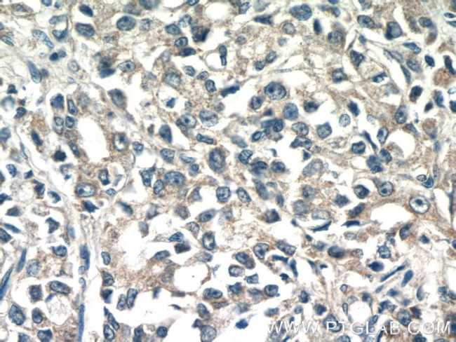 TMEM71 Antibody in Immunohistochemistry (Paraffin) (IHC (P))
