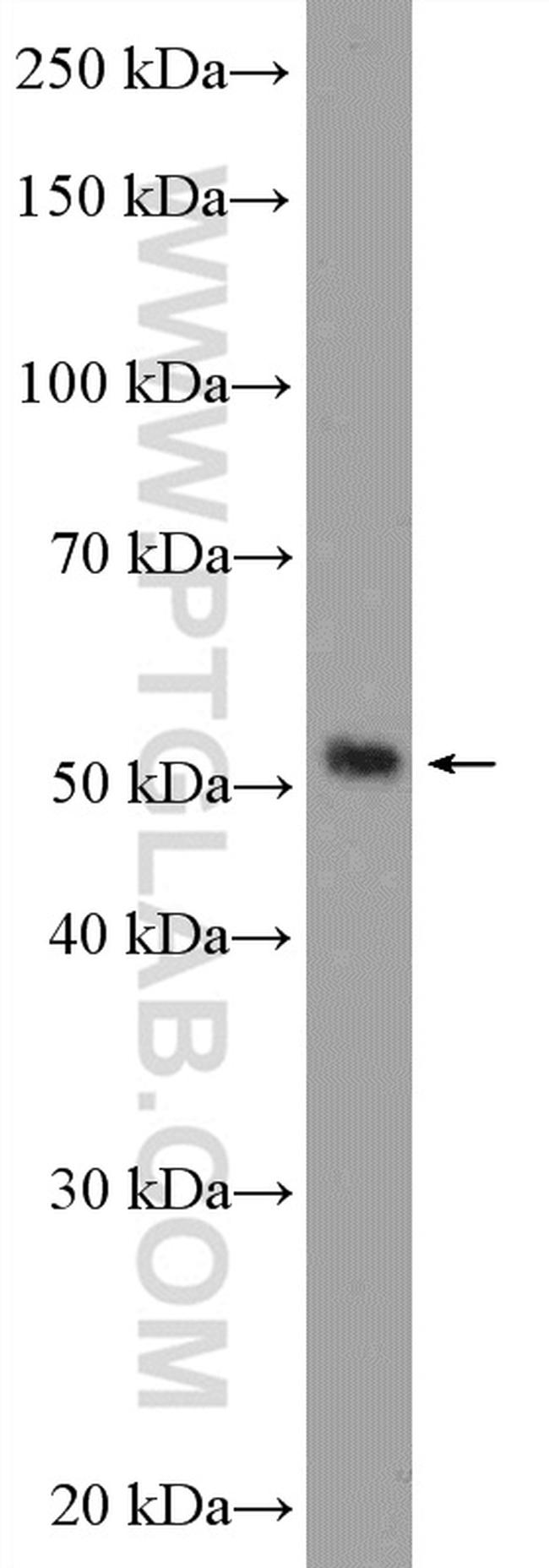 RILPL1 Antibody in Western Blot (WB)